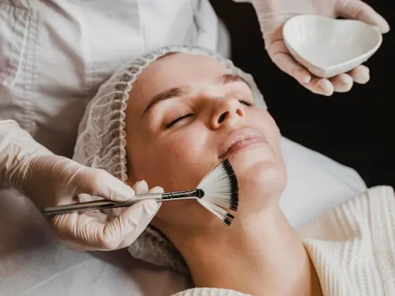 chemical-peel - Expert Dermatology Services