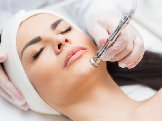 microdermabrasion- Expert Dermatology Services